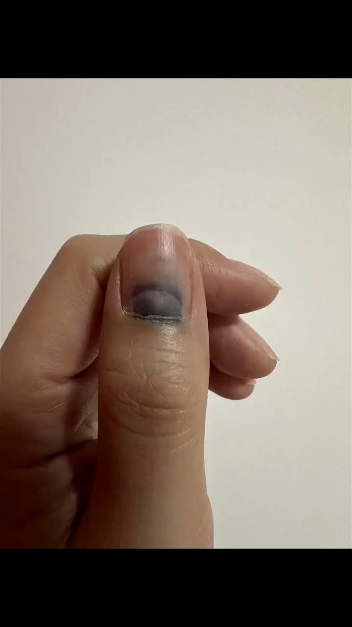 From pain to beauty: the inspiring story behind a nail's revival