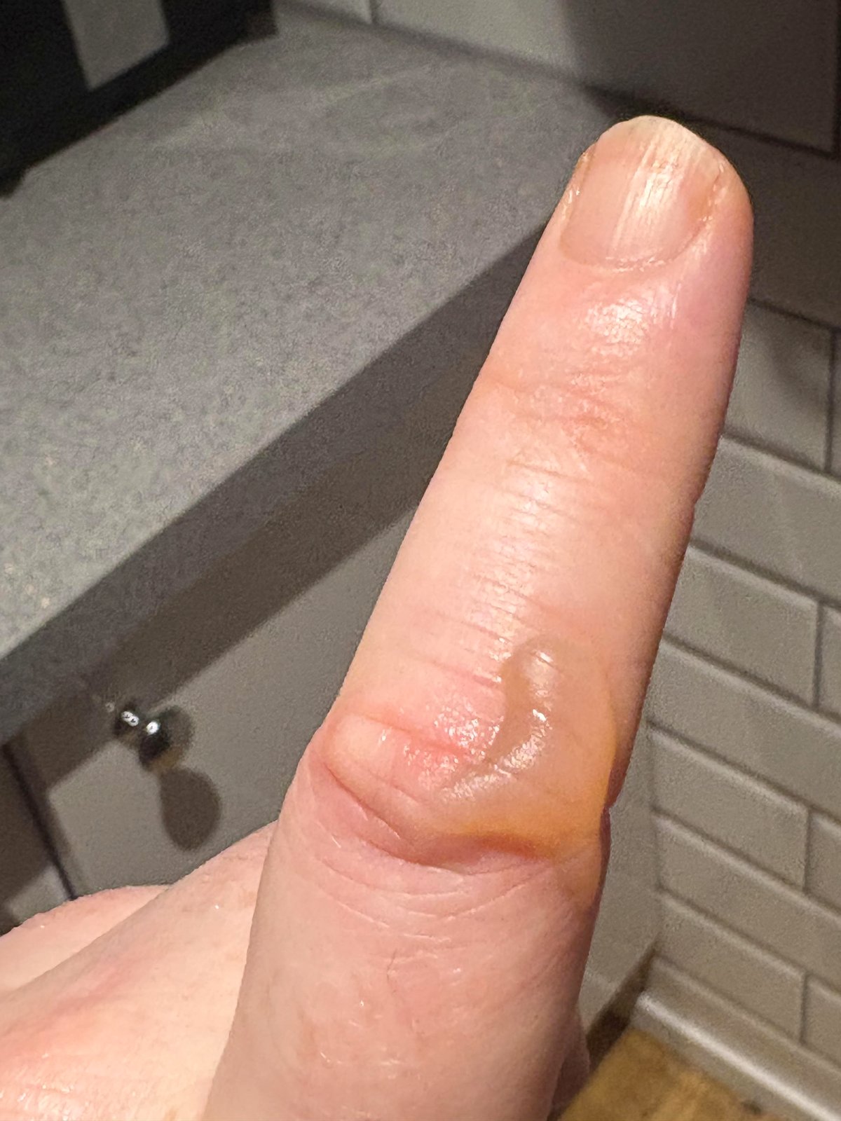 you'll be amazed How My Knuckle Lines Ended Up on a Blister