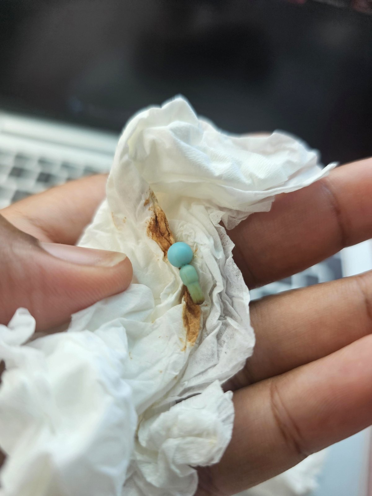 Stuck for a Decade: The Unbelievable Story Behind a Game Piece in His Ear