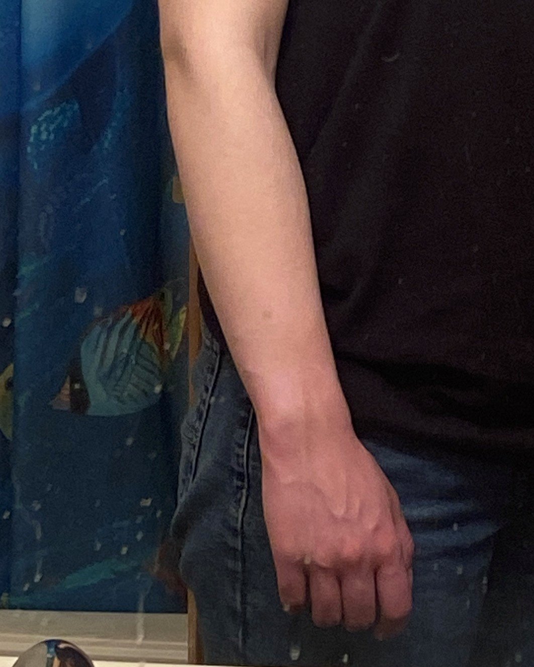Why my arm looked like a painting and what it revealed about my health