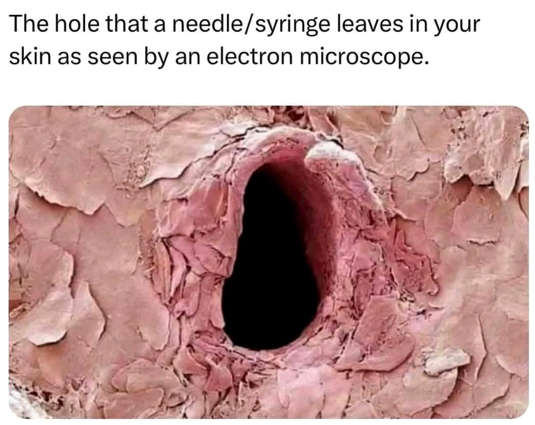 This small hole in your skin holds unexpected meaning