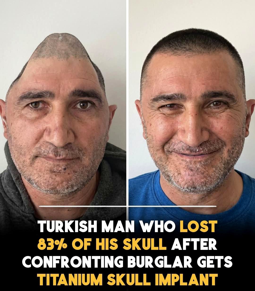 A hero's battle: how one man overcame tragedy with a groundbreaking surgery