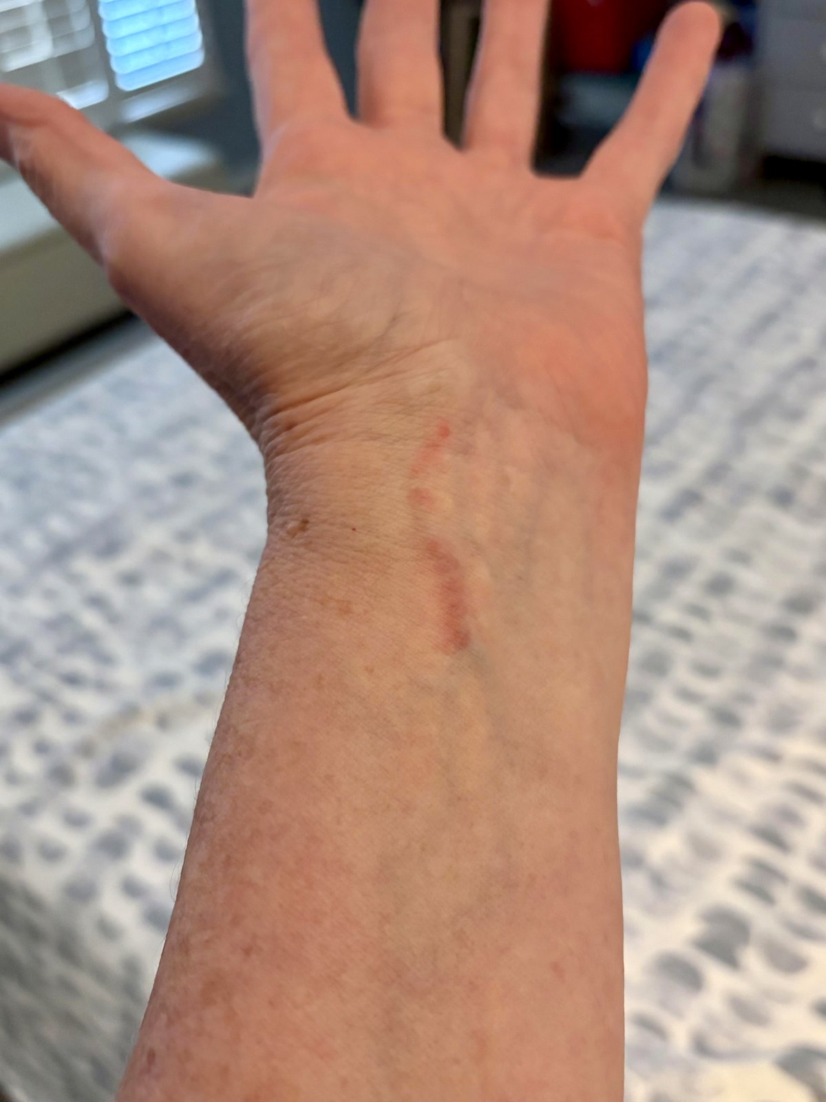 A shocking allergic reaction unveils a powerful story of resilience