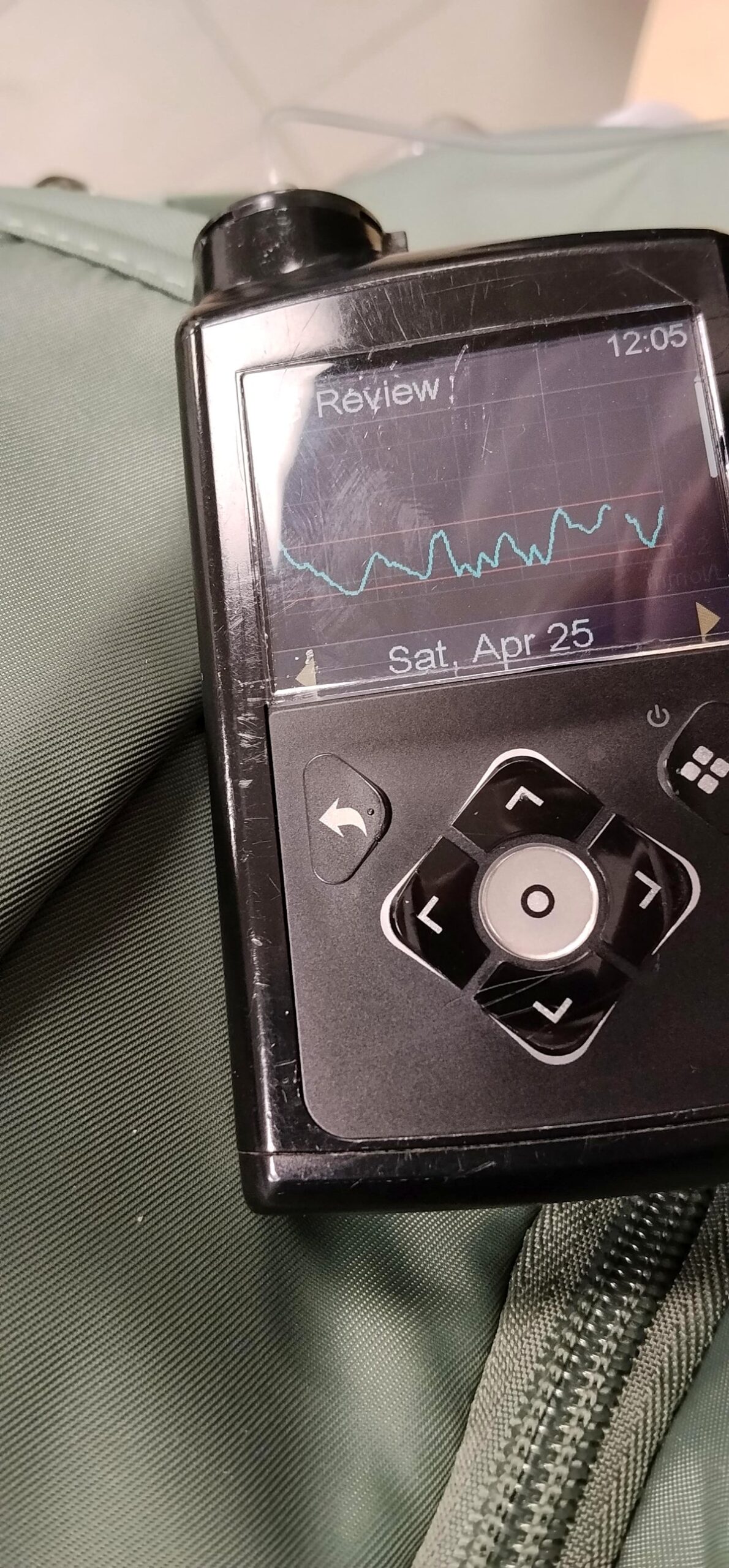 This device substitutes 0.25% of my vital pancreas!