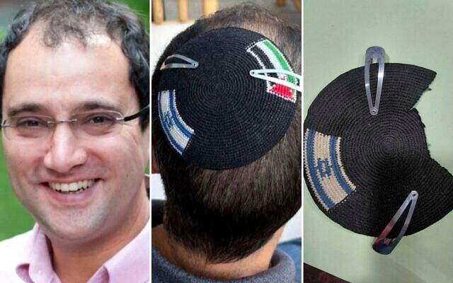 Israeli police arrested Alex Sinclair and cut up his kippah to take away a Palestinian flag.